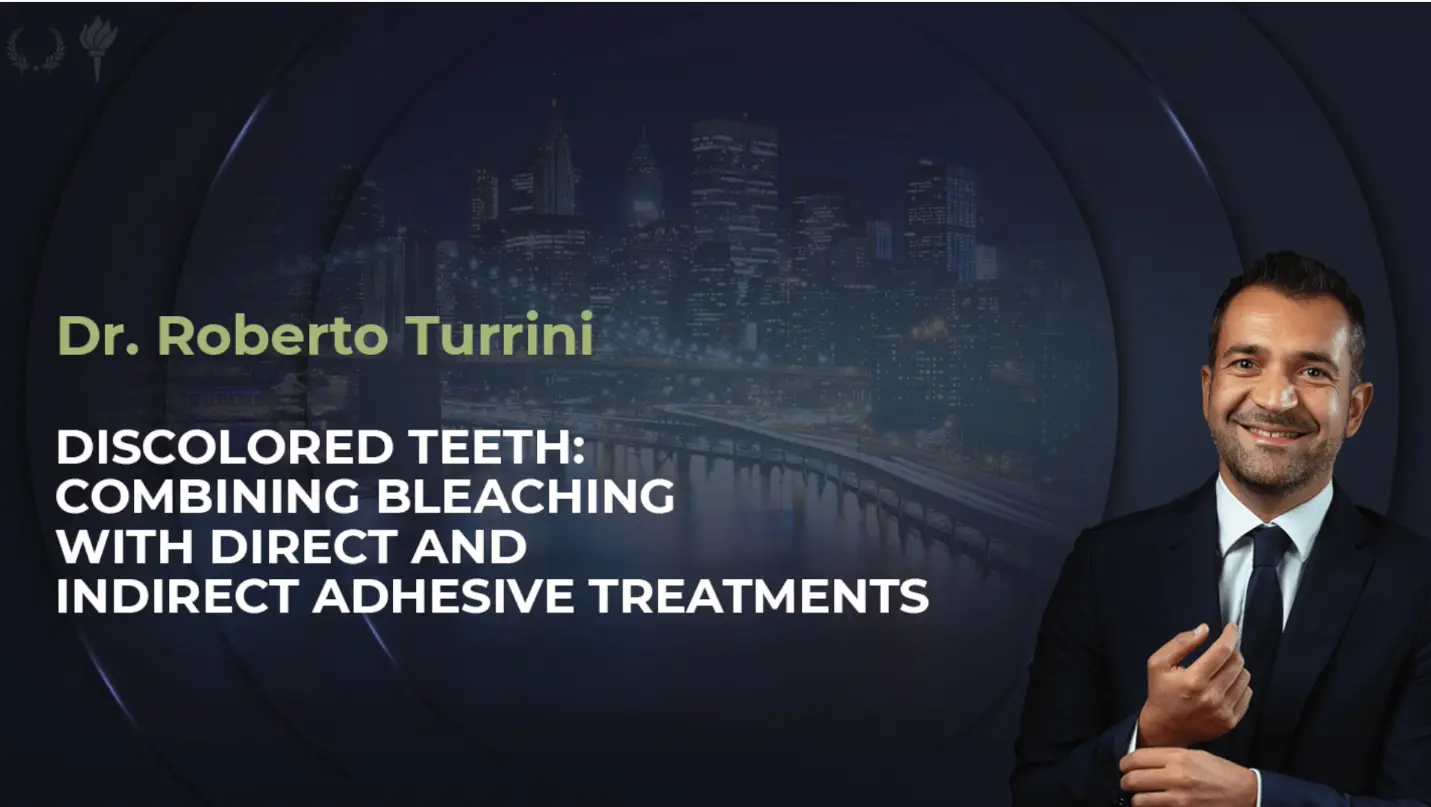 Discolored teeth: combining bleaching with direct and indirect adhesive treatments